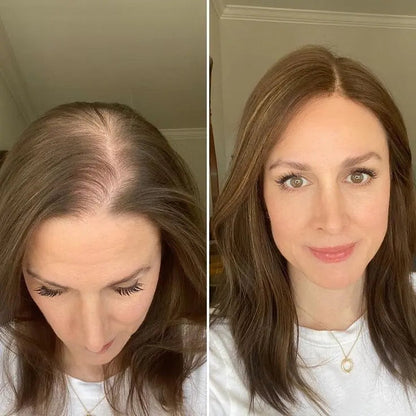 Luxury Silk Scalp Hair Topper – Instantly Boost Your Volume & Confidence