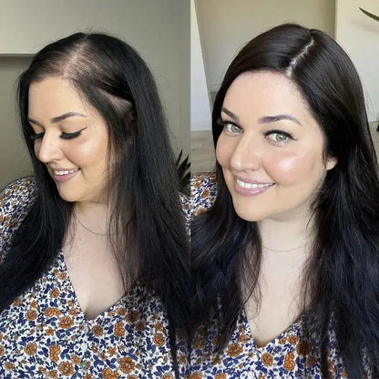 Luxury Silk Scalp Hair Topper – Instantly Boost Your Volume & Confidence