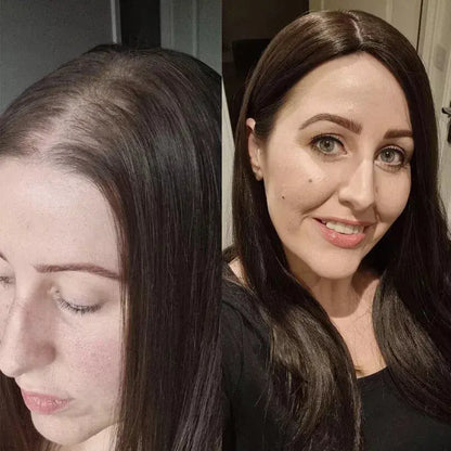 Luxury Silk Scalp Hair Topper – Instantly Boost Your Volume & Confidence